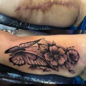 Scar cover up tattoo